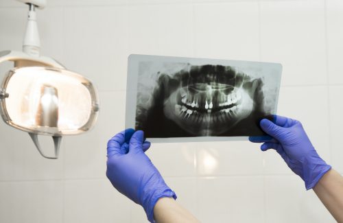 Printed X-Ray in dentist hands